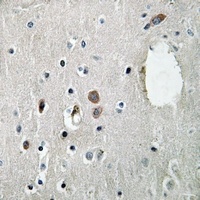 SLP76 (Phospho-Y128) Antibody