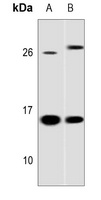 Galectin 1 Rabbit Polyclonal Antibody