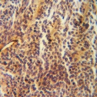 Galectin 1 Rabbit Polyclonal Antibody