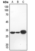 Galectin 3 Rabbit Polyclonal Antibody