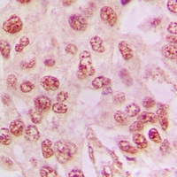 Galectin 3 Rabbit Polyclonal Antibody