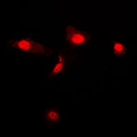 Galectin 3 Rabbit Polyclonal Antibody