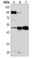 LHX1 Rabbit Polyclonal Antibody