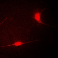 LIMK1 Rabbit Polyclonal Antibody