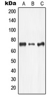 LIMK2 Rabbit Polyclonal Antibody