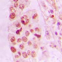 LIMK2 Rabbit Polyclonal Antibody