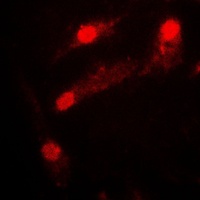 LIMK2 Rabbit Polyclonal Antibody