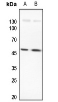 LMX1B Antibody
