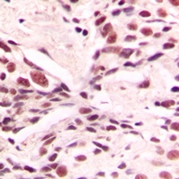 LMX1B Antibody