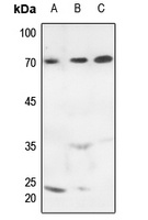 MARCKS (Phospho-S163) Rabbit Polyclonal Antibody