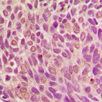 SMAD1 (Phospho-S187) Rabbit Polyclonal Antibody