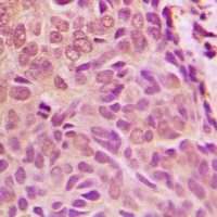SMAD1 Rabbit Polyclonal Antibody