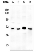 SMAD6 Rabbit Polyclonal Antibody