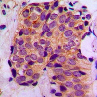MAGEA1 Rabbit Polyclonal Antibody