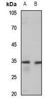 MAGEA3/6 Rabbit Polyclonal Antibody