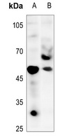 TAU (Phospho-T548) Rabbit Polyclonal Antibody