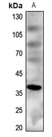 MC4 Receptor Antibody