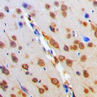 MC4 Receptor Antibody