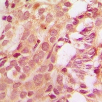 MCL1 Rabbit Polyclonal Antibody