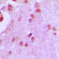 CDC46 Rabbit Polyclonal Antibody
