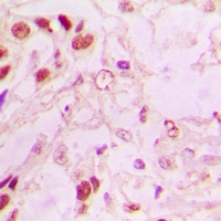 MDM2 Rabbit Polyclonal Antibody