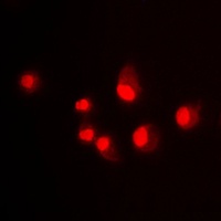 MDM2 Rabbit Polyclonal Antibody