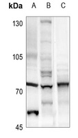 Menin Rabbit Polyclonal Antibody