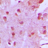 Menin Rabbit Polyclonal Antibody