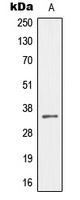 MEOX2 Rabbit Polyclonal Antibody