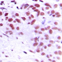 MEOX2 Rabbit Polyclonal Antibody
