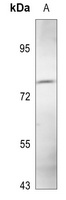 MLH1 Rabbit Polyclonal Antibody