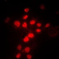 MLH1 Rabbit Polyclonal Antibody