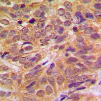 FOXO4 (Phospho-S197) Antibody