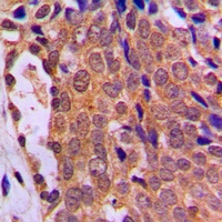 FOXO4 Rabbit Polyclonal Antibody