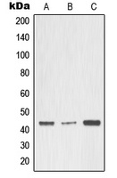 MMP3 Rabbit Polyclonal Antibody