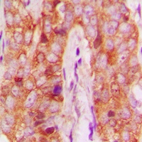 MMP13 Rabbit Polyclonal Antibody