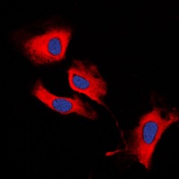 MMP13 Rabbit Polyclonal Antibody