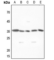 MNAT1 Rabbit Polyclonal Antibody