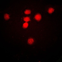 MRE11 Rabbit Polyclonal Antibody