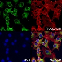 ATP6 Rabbit Polyclonal Antibody