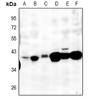 MT-ND2 Rabbit Polyclonal Antibody