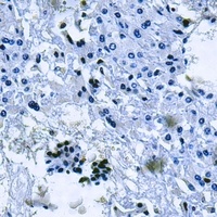 MT-ND2 Rabbit Polyclonal Antibody