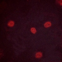 MYBL2 (Phospho-S577) Antibody