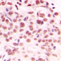 c-Myc (Phospho-S62) Antibody