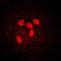 c-Myc (Phospho-S62) Antibody