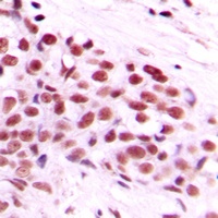 c-Myc (Phospho-T58) Rabbit Polyclonal Antibody