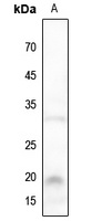 NBL1 Rabbit Polyclonal Antibody