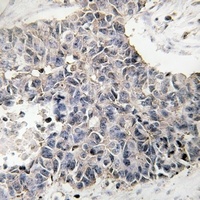 NBL1 Rabbit Polyclonal Antibody