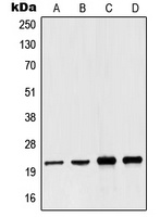NDUFB10 Antibody