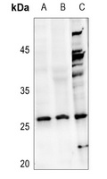 NDUFV2 Rabbit Polyclonal Antibody